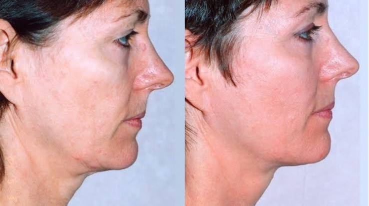 Non Invasive Treatment Hampshire