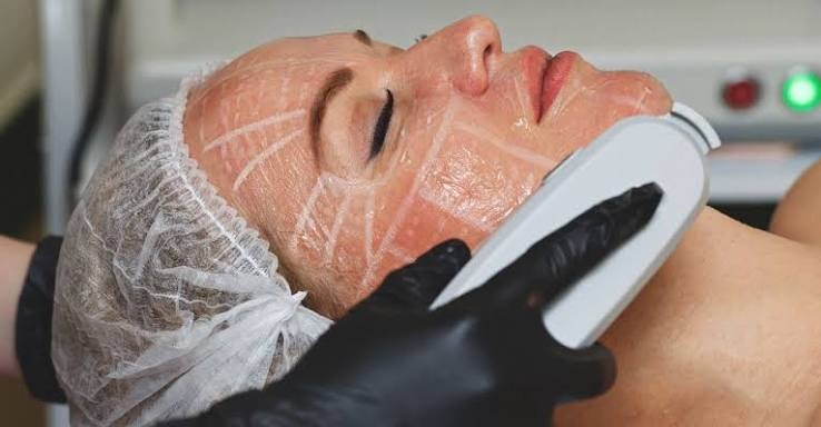 Non Invasive Treatment South East London